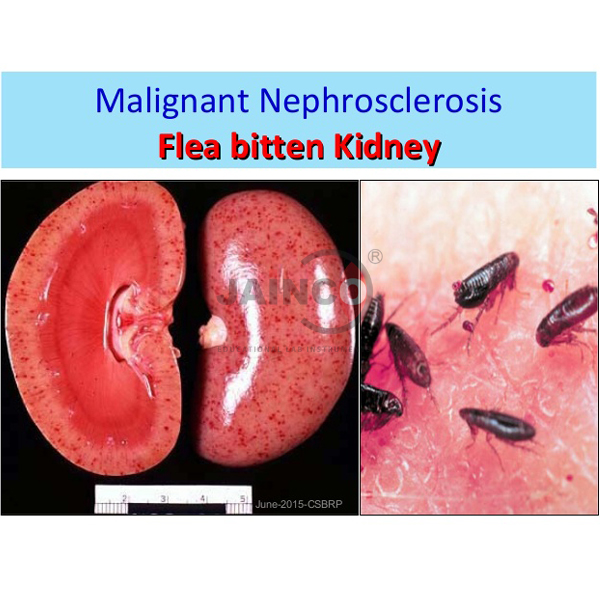 Malignant Nephrosclerosis, Flea Bitten Kidney Model