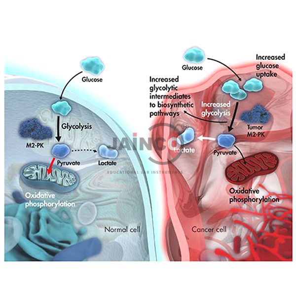 Lung Abscess Complicated by Fungus Ball Model