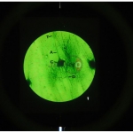 Nerve and Muscle Action Microslide